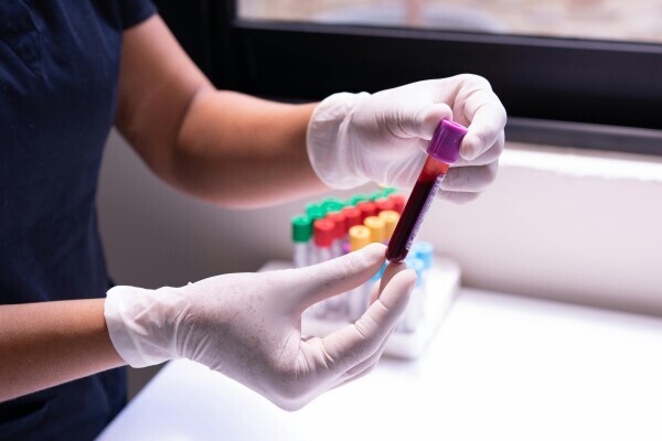 Image for article titled Changes to How We Communicate Test Results